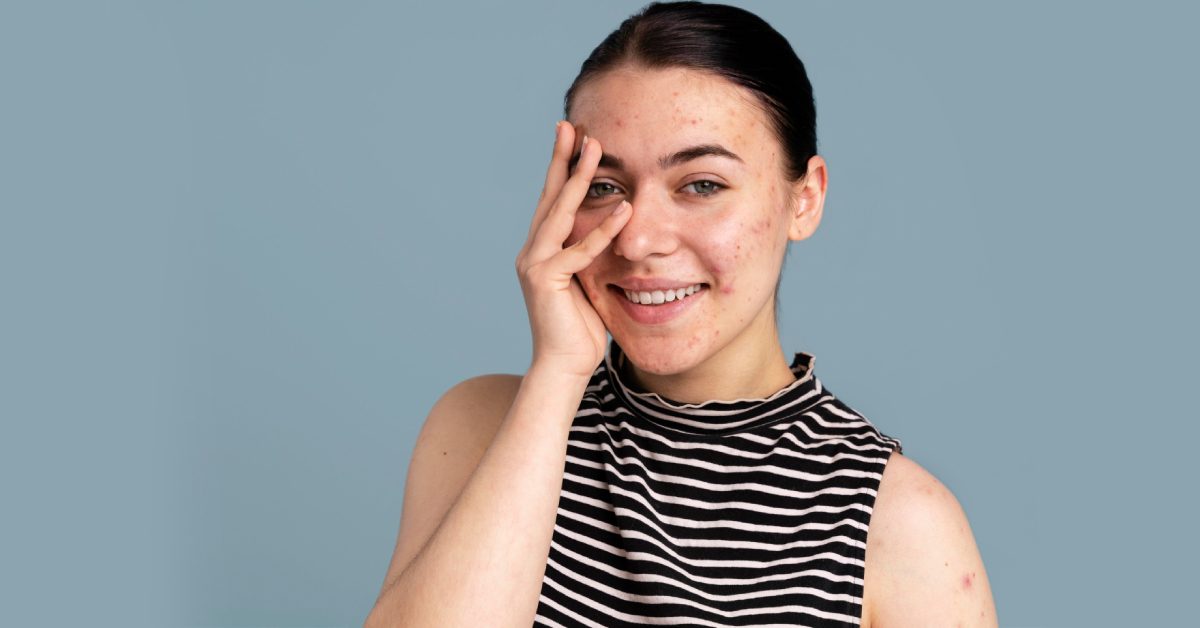 How to get rid of dull skin naturally using simple ingredients