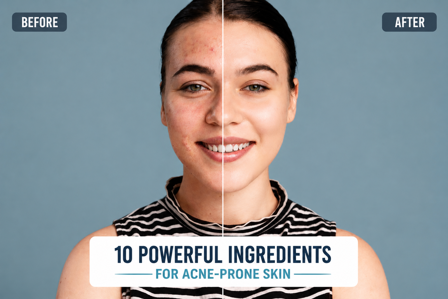 Powerful Ingredients for Acne-Prone Skin that help support a clearer and healthier complexion