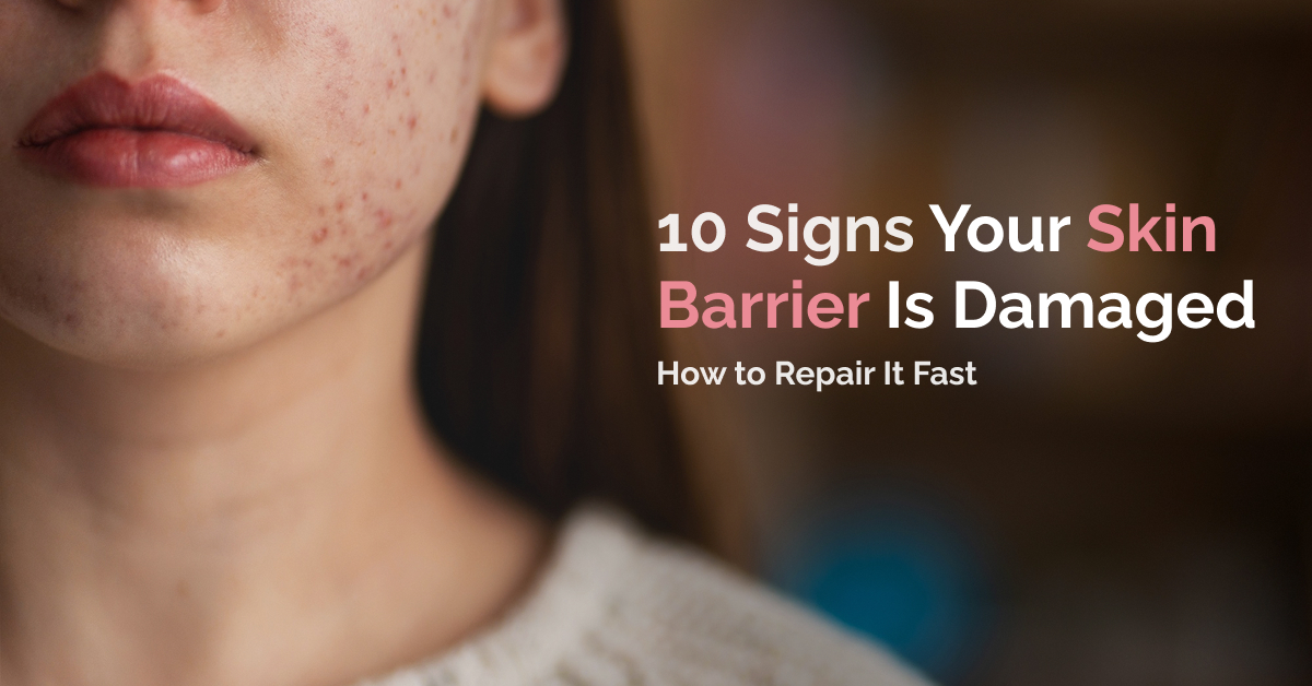 Damaged Skin Barrier signs and effective ways to repair your skin barrier naturally